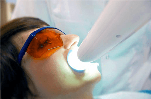 Understanding the Causes of Teeth Sensitivity St Helens