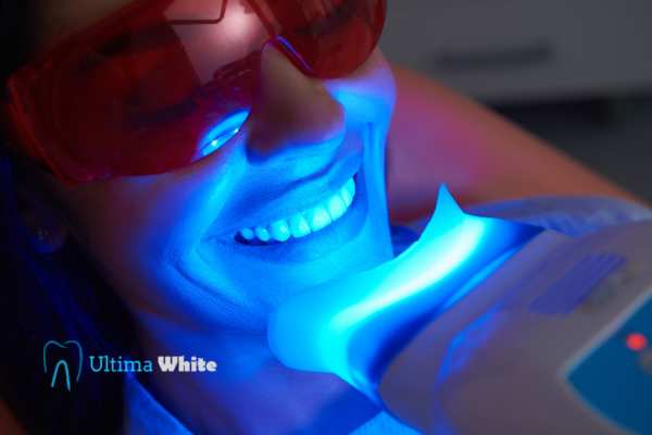 Professional Teeth Whitening Options St Helens