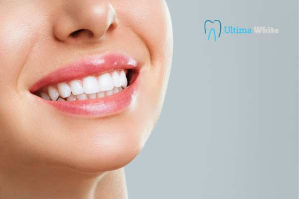 Common Mistakes That Can Ruin Your Whitening Results St Helens