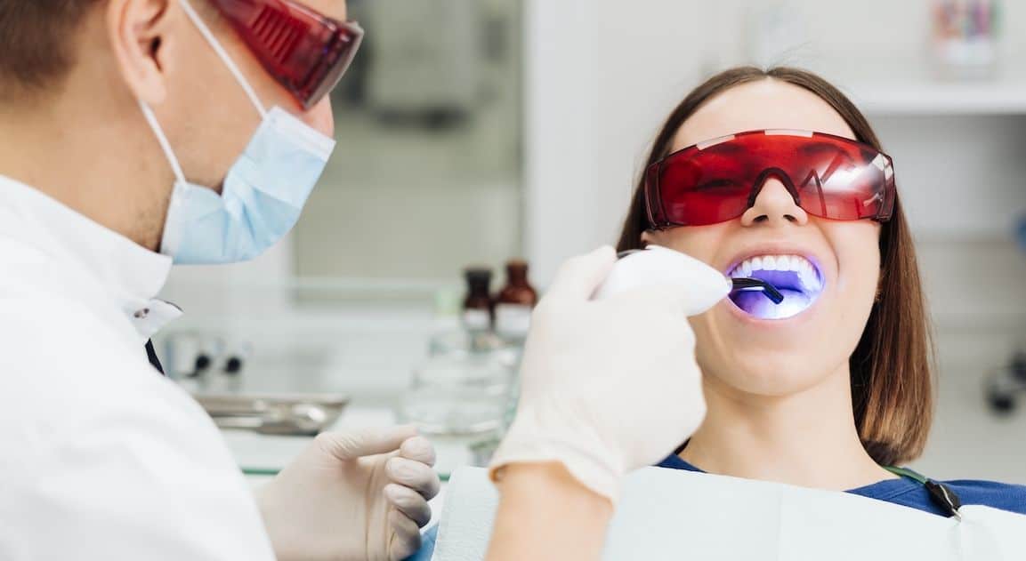 Do Dental Crowns Change Colour After Teeth Whitening St Helens?