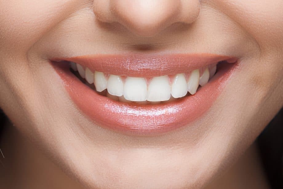 The Role of a Balanced Diet in Long-Term Whitening Results St Helens