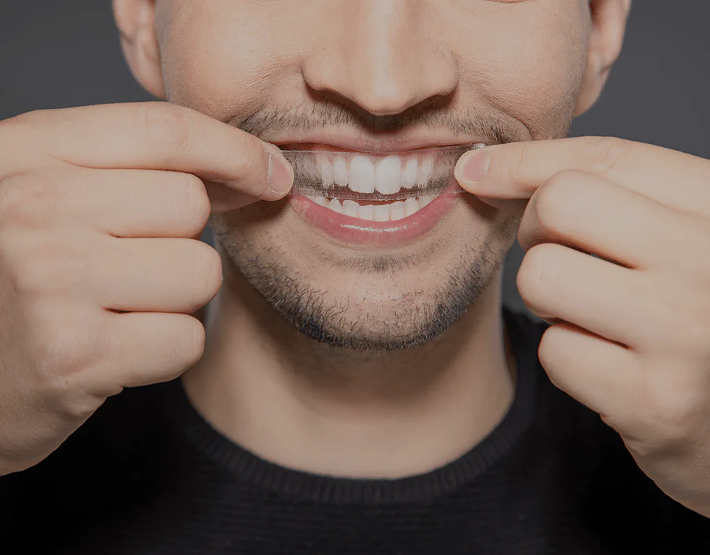 Can You Whiten Natural Teeth Without Harsh Chemicals St Helens?