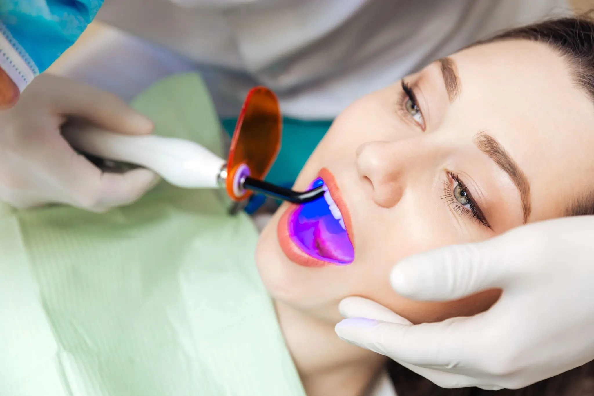 Is Laser Teeth Whitening Safe and Effective St Helens?