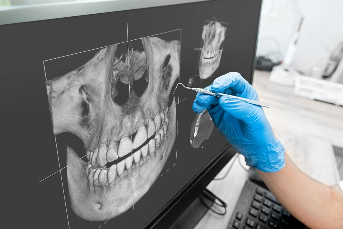 How Is AI Transforming Dental Treatment Planning St Helens?