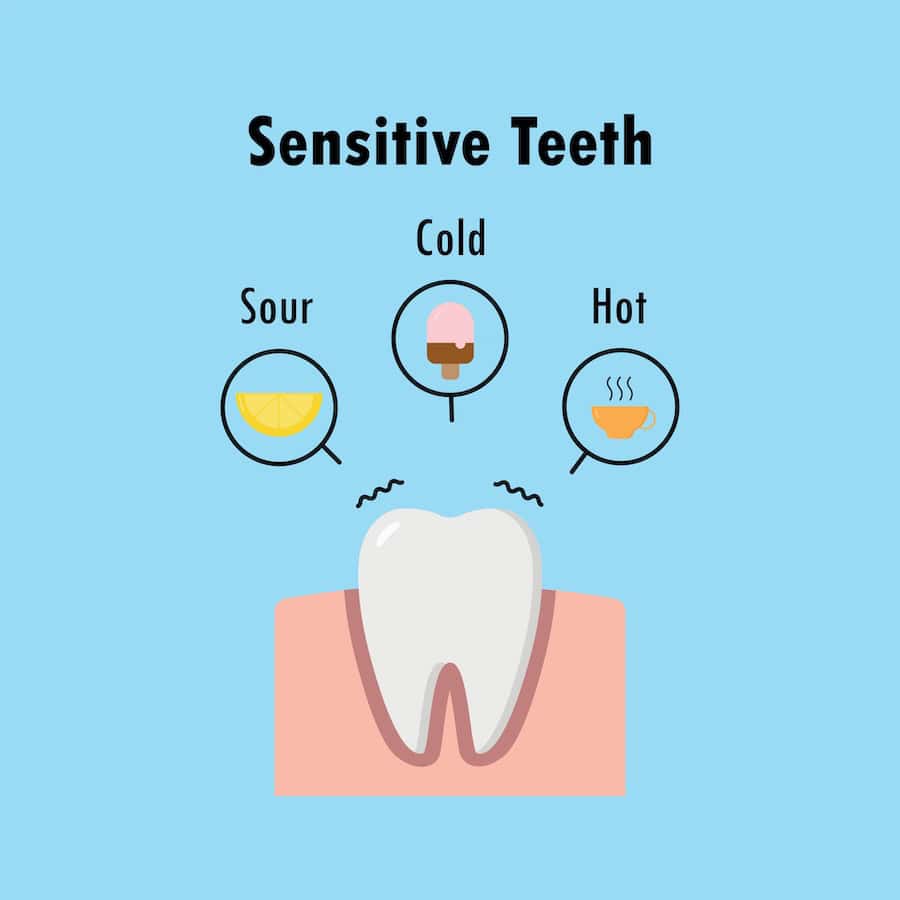 Why Do Teeth Become Sensitive After Whitening Treatments St Helens?