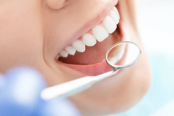 How to Maintain Your Whiter Smile After Treatment St Helens