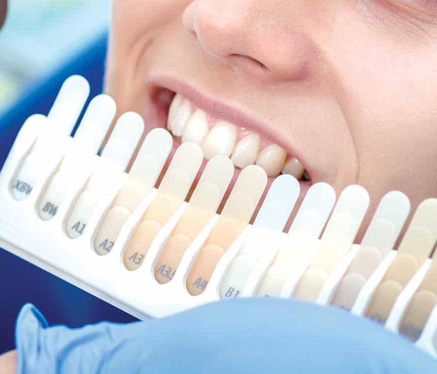 Is Laser Teeth Whitening Worth It for a Brighter, Confident Smile St Helens?