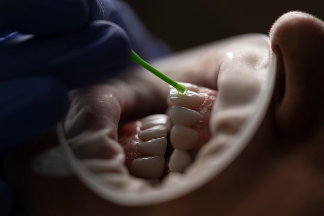 How Saliva Protects Your Teeth and Gums St Helens