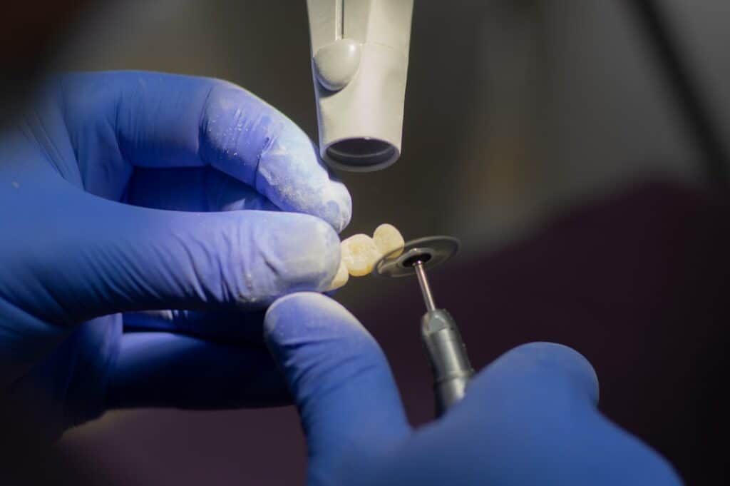Customised Dental Solutions: Crowns, Aligners, and Implants St Helens