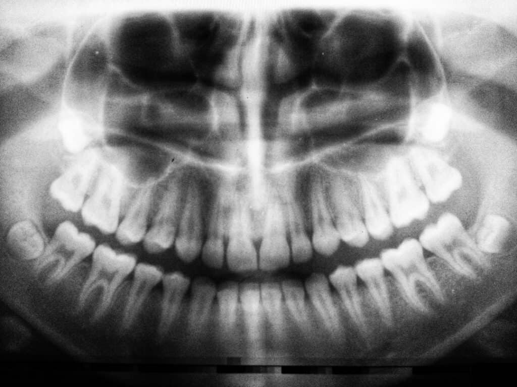 The Future of 3D Printing in Oral Healthcare St Helens